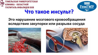 Что такое инсульт?